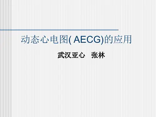 动态心电图的应用