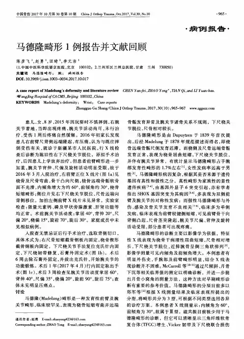 马德隆畸形1例报告并文献回顾