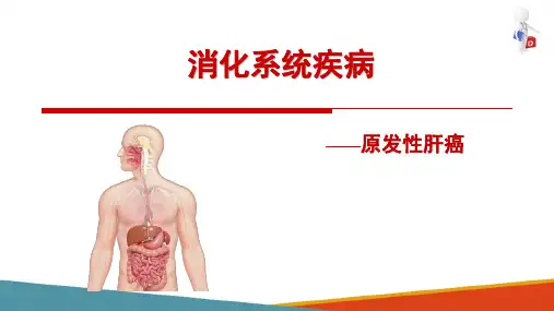 消化系统肿瘤—肝癌(病理学课件)