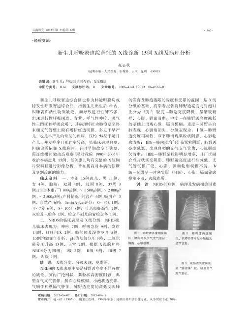 新生儿呼吸窘迫综合征的X线诊断15例X线及病理分析