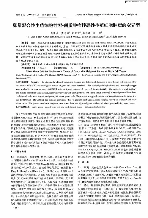 卵巢混合性生殖细胞性索-间质肿瘤伴恶性生殖细胞肿瘤的变异型