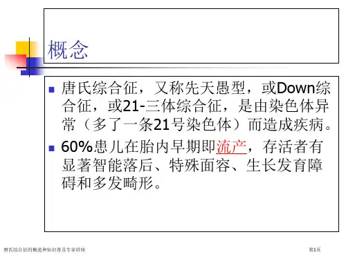 唐氏综合征的概述和知识普及专家讲座