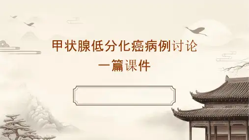 甲状腺低分化癌病例讨论一篇课件