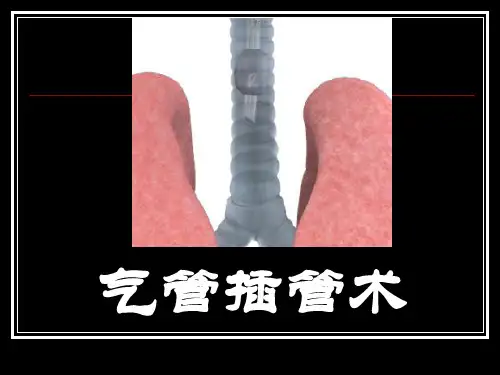 气管插管教学PPT课件