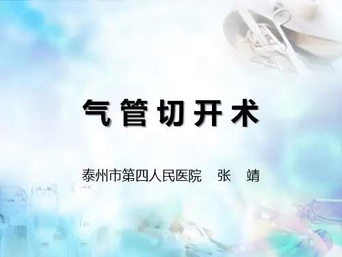 气管切开术