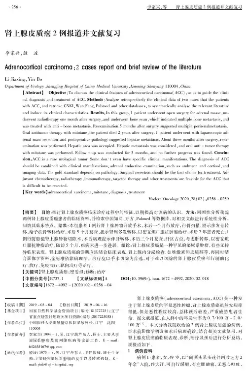 肾上腺皮质癌2例报道并文献复习