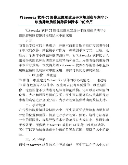 Vitaworks软件CT影像三维重建及手术规划在早期非小细胞肺癌胸腔镜肺段切除术中的应用