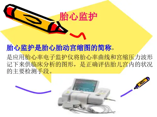 胎心监护