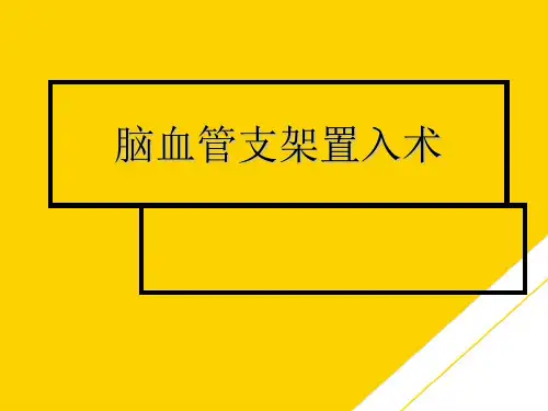 脑血管支架置入术(最全版)PTT文档