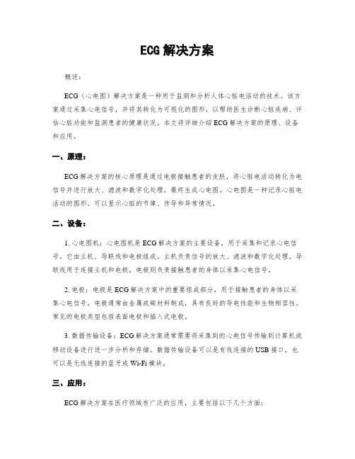 ECG解决方案