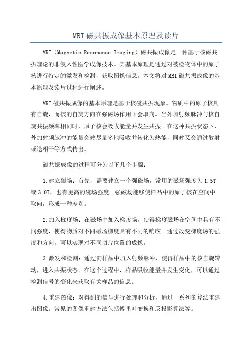 MRI磁共振成像基本原理及读片