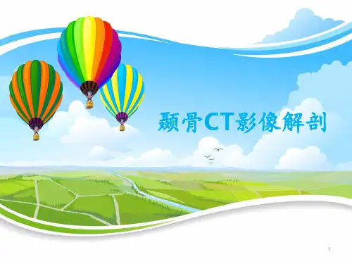 颞骨CT影像解剖  ppt课件