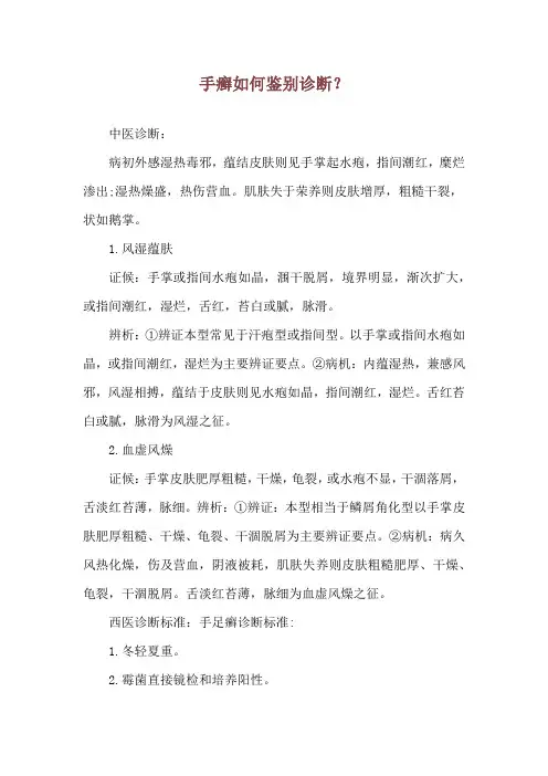 手癣如何鉴别诊断？