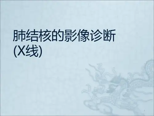 肺结核的影像诊断(X线)PPT课件