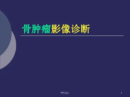 骨肿瘤影像学诊断最新ppt课件