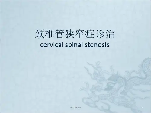 颈椎管狭窄症医学PPT
