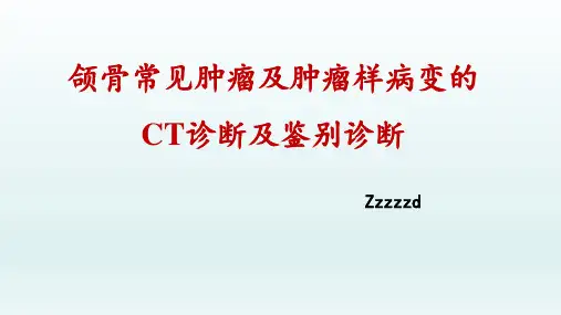 颌骨常见肿瘤及非肿瘤病变的CT诊断