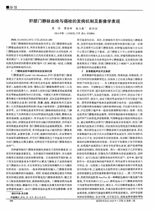 肝脏门静脉血栓与癌栓的发病机制及影像学表现