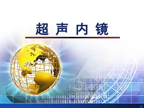 超 声 内 镜 ppt课件