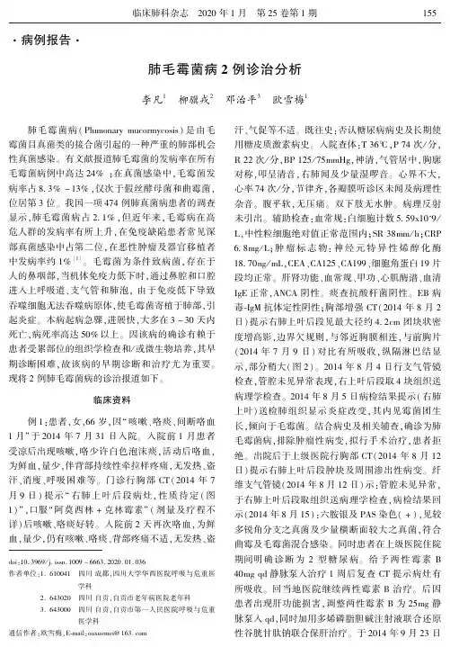 肺毛霉菌病2例诊治分析