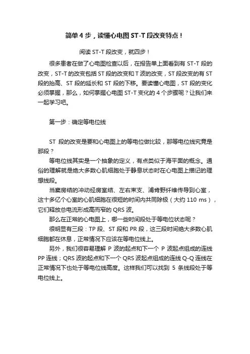 简单4步，读懂心电图ST-T段改变特点！