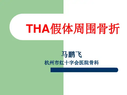 业务学习假体周围骨折