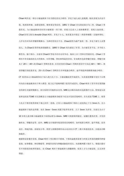 CHARIS畸形
