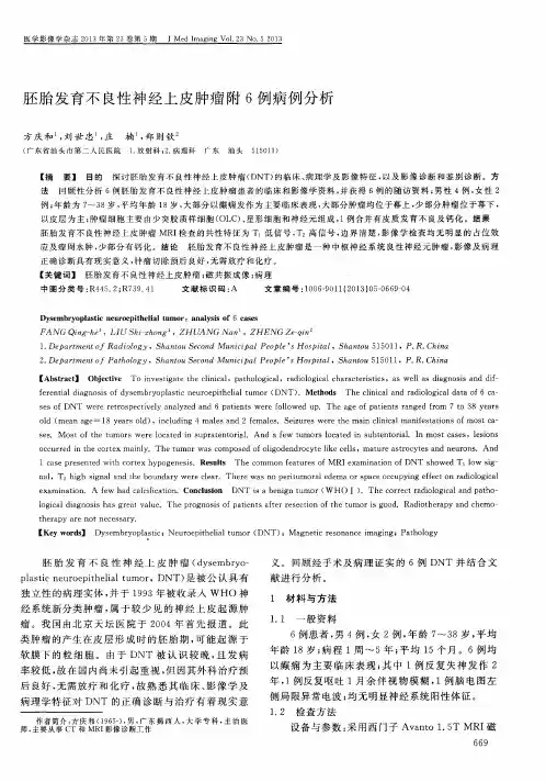 胚胎发育不良性神经上皮肿瘤附6例病例分析