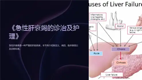 《急性肝衰竭的诊治及护理》