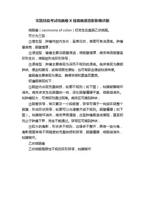 实践技能考试结肠癌X线胃肠道造影影像诊断