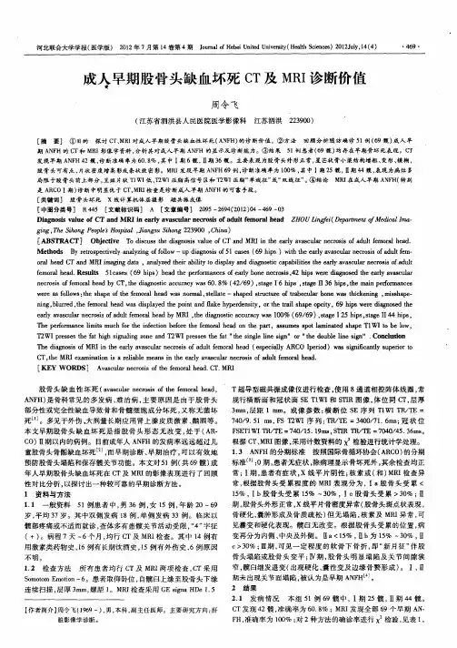 成人早期股骨头缺血坏死CT及MRI诊断价值