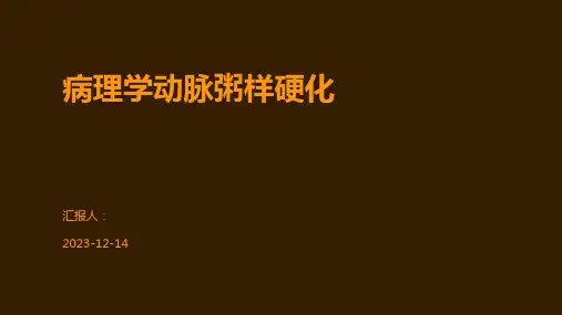 病理学动脉粥样硬化