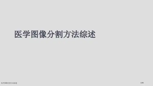 医学图像分割方法综述