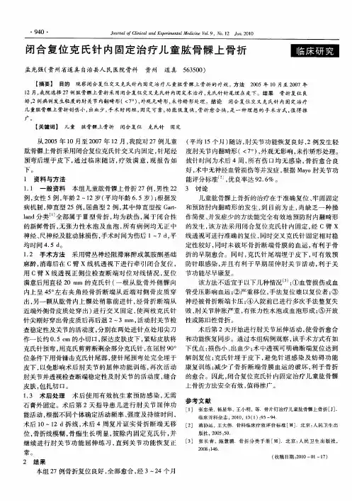 闭合复位克氏针内固定治疗儿童肱骨髁上骨折