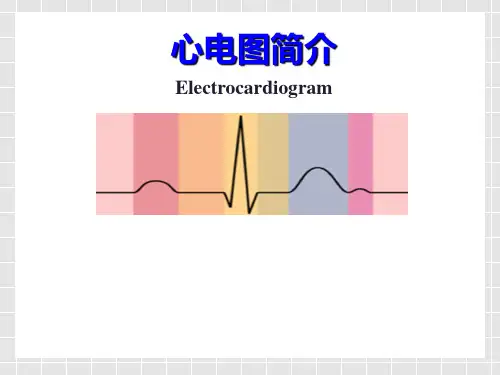 心电图的正确识别PPT课件