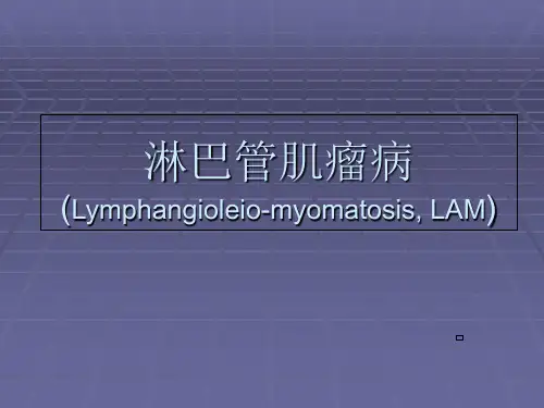 淋巴管肌瘤病课件