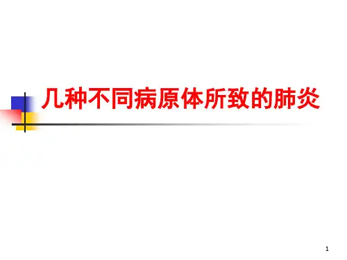 几种不同病因肺炎【45页】