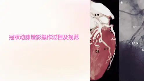 冠状动脉造影操作过程及规范