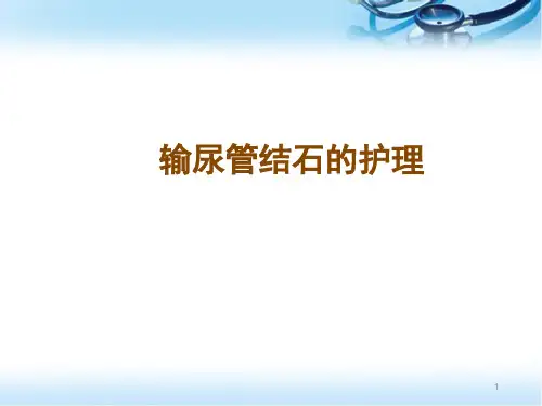 (医学课件)输尿管结石的护理PPT幻灯片
