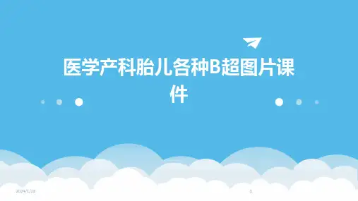 2024版医学产科胎儿各种B超图片课件