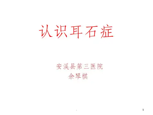 耳石症的诊治ppt课件