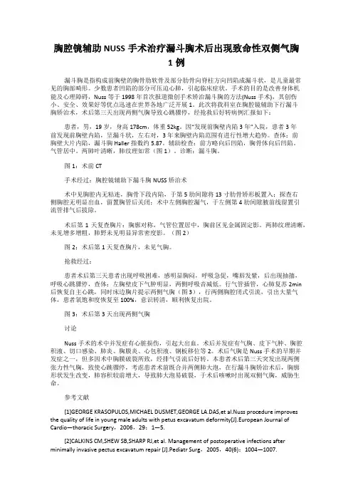 胸腔镜辅助NUSS手术治疗漏斗胸术后出现致命性双侧气胸1例