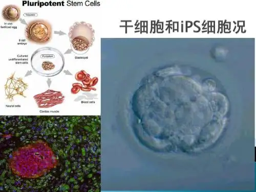 干细胞研究