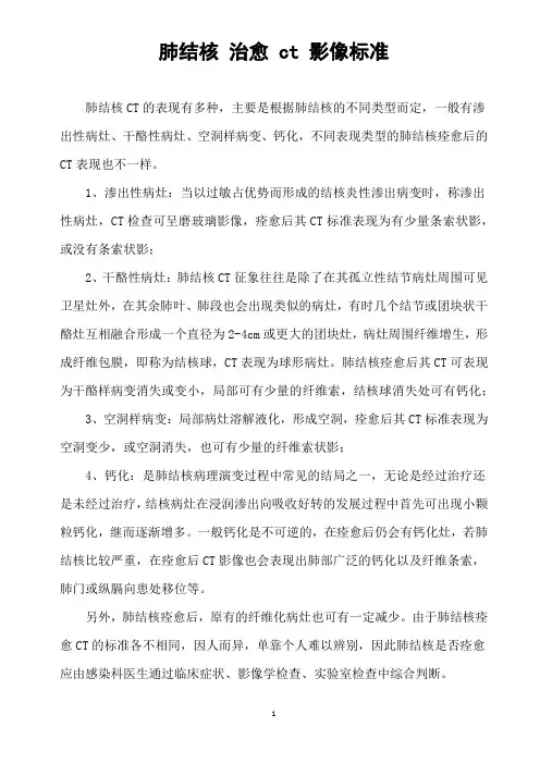 肺结核-治愈-ct-影像标准