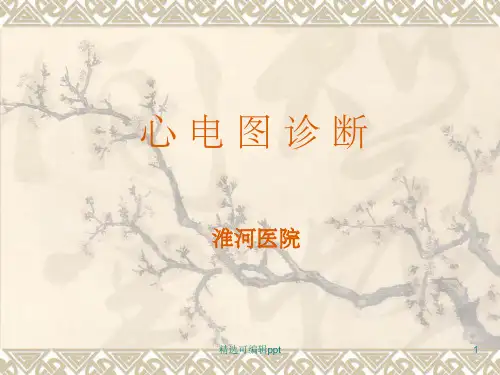 心电图心电向量详细讲解