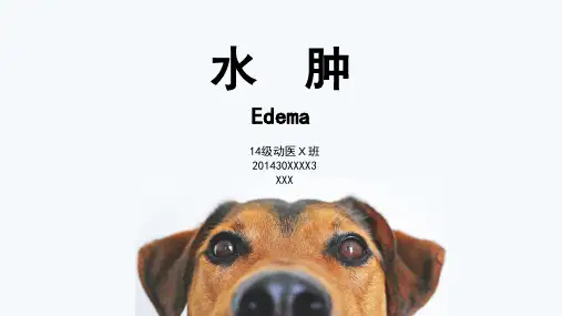 水肿鉴别诊断报告