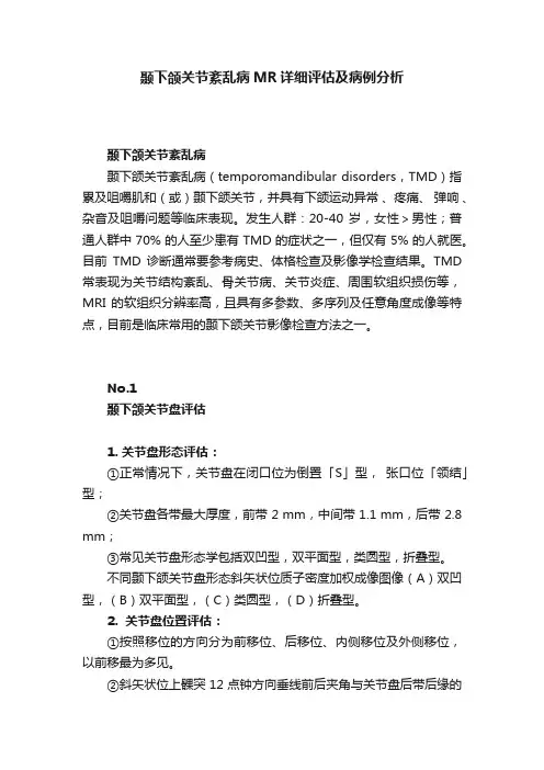 颞下颌关节紊乱病MR详细评估及病例分析