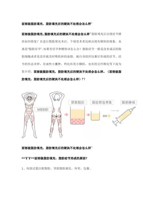 面部做脂肪填充,脂肪填充后的硬块不处理会怎么样~