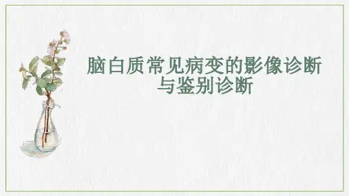 脑白质病变的影像诊断与鉴别诊断
