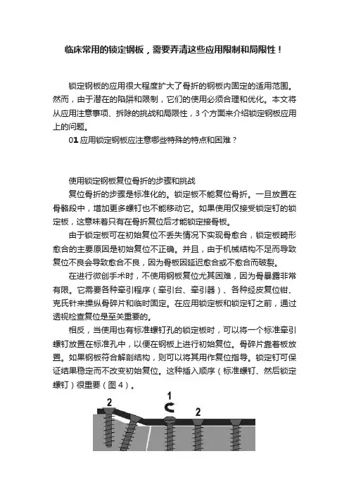 临床常用的锁定钢板，需要弄清这些应用限制和局限性！
